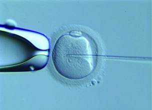 试管婴儿受精失败的原因是精子还是卵子导致?