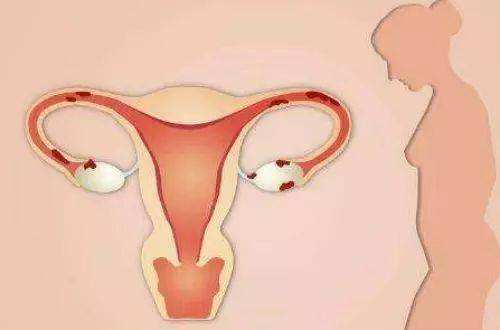 试管婴儿治疗期间，如何养好子宫内膜?