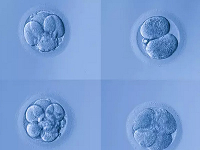 泰国试管婴儿移植胚胎的好坏要怎么看？