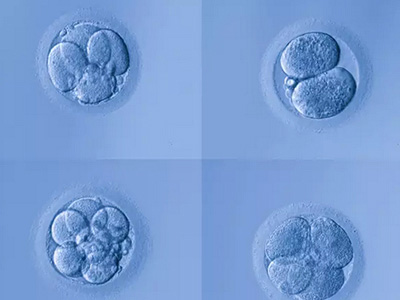 想高龄试管婴儿一次成功?这六点必看