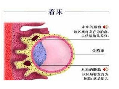 影响试管婴儿着床失败的原因有哪些?